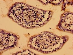 Invitrogen LIAS Polyclonal Antibody 100 &mu;g; Unconjugated:Antibodies,