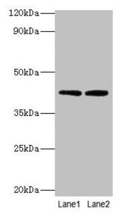 Invitrogen LIAS Polyclonal Antibody 100 &mu;g; Unconjugated:Antibodies,