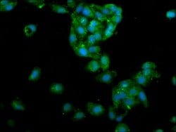 Invitrogen LIPA Polyclonal Antibody 100 &mu;g; Unconjugated:Antibodies,