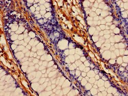 Invitrogen LIPA Polyclonal Antibody 100 &mu;g; Unconjugated:Antibodies,
