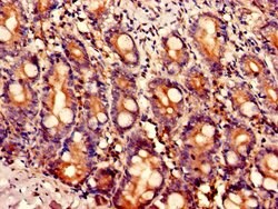 Invitrogen LIPA Polyclonal Antibody 100 &mu;g; Unconjugated:Antibodies,