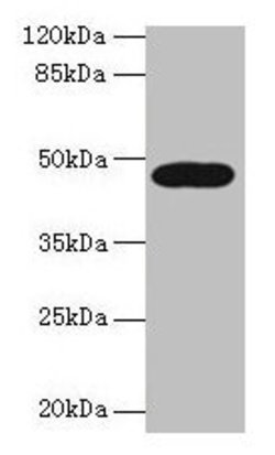 Invitrogen LIPA Polyclonal Antibody 100 &mu;g; Unconjugated:Antibodies,