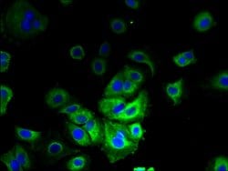 Invitrogen LMF2 Polyclonal Antibody 100 &mu;g; Unconjugated:Antibodies,