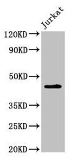 Invitrogen LPXN Polyclonal Antibody 100 &mu;g; Unconjugated:Antibodies,