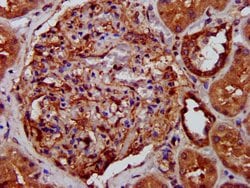 Invitrogen LRP130 Polyclonal Antibody 100 &mu;g; Unconjugated:Antibodies,