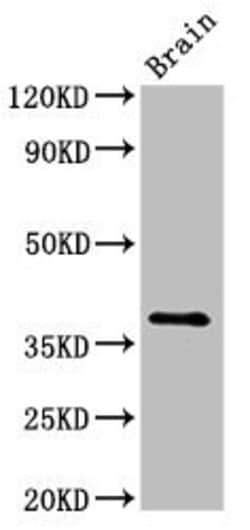 Invitrogen LUM Polyclonal Antibody 100 &mu;g; Unconjugated:Antibodies,
