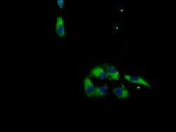 Invitrogen MAS1L Polyclonal Antibody 100 &mu;g; Unconjugated:Antibodies,