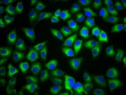 Invitrogen MC1R Polyclonal Antibody 100 &mu;g; Unconjugated:Antibodies,
