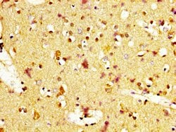 Invitrogen MC1R Polyclonal Antibody 100 &mu;g; Unconjugated:Antibodies,