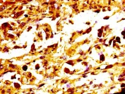 Invitrogen MC1R Polyclonal Antibody 100 &mu;g; Unconjugated:Antibodies,