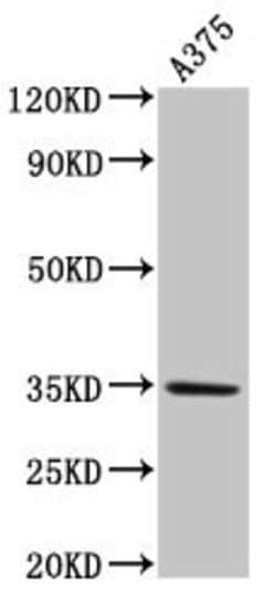 Invitrogen MC1R Polyclonal Antibody 100 &mu;g; Unconjugated:Antibodies,