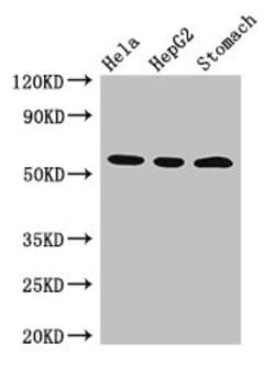 Invitrogen MDMX Polyclonal Antibody 100 &mu;g; Unconjugated:Antibodies,