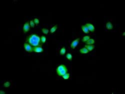 Invitrogen PSMB2 Polyclonal Antibody 100 &mu;g; Unconjugated:Antibodies,