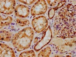 Invitrogen PSMB2 Polyclonal Antibody 100 &mu;g; Unconjugated:Antibodies,