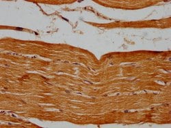 Invitrogen PSMB2 Polyclonal Antibody 100 &mu;g; Unconjugated:Antibodies,