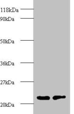 Invitrogen PSMB2 Polyclonal Antibody 100 &mu;g; Unconjugated:Antibodies,