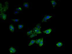 Invitrogen MCD Polyclonal Antibody 100 &mu;g; Unconjugated:Antibodies,