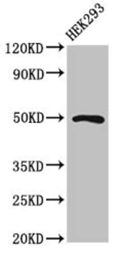HB9 Polyclonal Antibody:Antibodies, Polyclonal