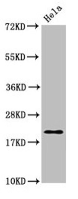 Invitrogen MOBP Polyclonal Antibody 100 &mu;g | Buy Online | Invitrogen&trade; | Fisher Scientific