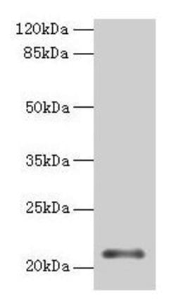 Invitrogen MOCS2 Polyclonal Antibody 100 &mu;g; Unconjugated:Antibodies,