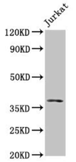 Invitrogen MOS Polyclonal Antibody 100 &mu;g | Buy Online | Invitrogen&trade; | Fisher Scientific