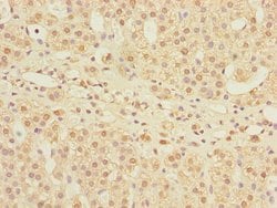 Invitrogen MPI Polyclonal Antibody 100 &mu;L | Buy Online | Invitrogen&trade; | Fisher Scientific