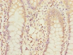 Invitrogen MPI Polyclonal Antibody 100 &mu;L | Buy Online | Invitrogen&trade; | Fisher Scientific