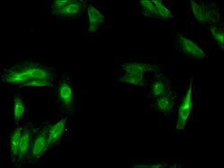 Invitrogen MSH4 Polyclonal Antibody 100 &mu;g; Unconjugated:Antibodies,