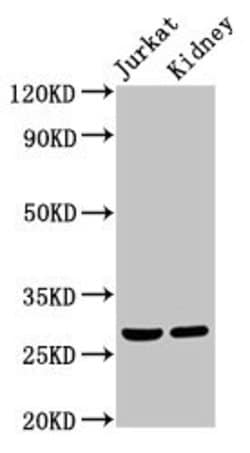 Invitrogen MSX2 Polyclonal Antibody 100 &mu;g; Unconjugated:Antibodies,