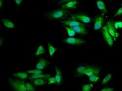 Invitrogen MVD Polyclonal Antibody 100 &mu;g; Unconjugated:Antibodies,
