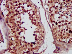 Invitrogen MVD Polyclonal Antibody 100 &mu;g; Unconjugated:Antibodies,
