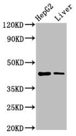 Invitrogen MVD Polyclonal Antibody 100 &mu;g; Unconjugated:Antibodies,