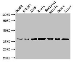 Invitrogen MYF6 Polyclonal Antibody 100 &mu;g; Unconjugated:Antibodies,