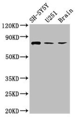 Invitrogen NCDN Polyclonal Antibody 100 &mu;g; Unconjugated:Antibodies,
