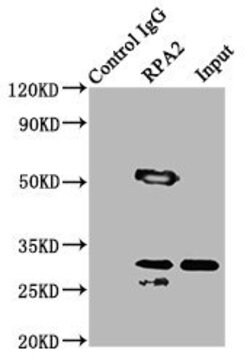 Invitrogen RPA2 Polyclonal Antibody 100 &mu;g; Unconjugated:Antibodies,