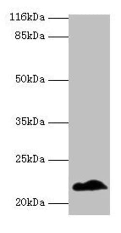 Invitrogen NDUFB5 Polyclonal Antibody 100 &mu;g; Unconjugated:Antibodies,