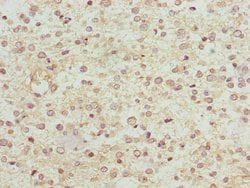 Invitrogen NDUFS1 Polyclonal Antibody 100 &mu;L; Unconjugated:Antibodies,