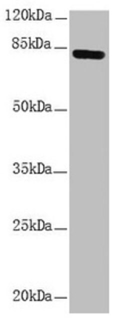 Invitrogen NDUFS1 Polyclonal Antibody 100 &mu;L; Unconjugated:Antibodies,