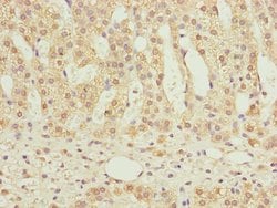 Invitrogen NDUFS6 Polyclonal Antibody 100 &mu;L | Buy Online | Invitrogen&trade; | Fisher Scientific