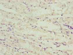 Invitrogen NDUFS6 Polyclonal Antibody 100 &mu;L | Buy Online | Invitrogen&trade; | Fisher Scientific