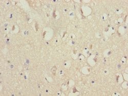 Invitrogen NDUFV1 Polyclonal Antibody 100 &mu;L; Unconjugated:Antibodies,