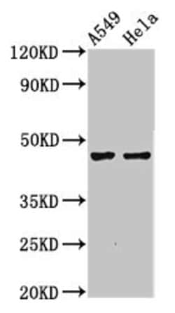 Invitrogen NMBR Polyclonal Antibody 100 &mu;g; Unconjugated:Antibodies,