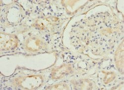 Invitrogen NNMT Polyclonal Antibody 100 &mu;L; Unconjugated:Antibodies,