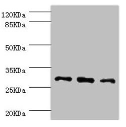 Invitrogen NNMT Polyclonal Antibody 100 &mu;L; Unconjugated:Antibodies,