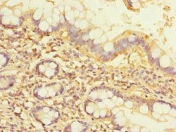 Invitrogen NOL10 Polyclonal Antibody 100 &mu;g; Unconjugated:Antibodies,