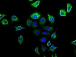 Invitrogen NPY2R Polyclonal Antibody 100 &mu;g | Buy Online | Invitrogen&trade; | Fisher Scientific
