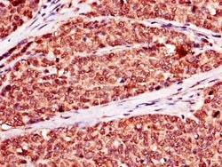 Invitrogen NR2C2AP Polyclonal Antibody 100 &mu;g; Unconjugated:Antibodies,