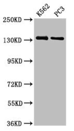 Invitrogen Nardilysin Polyclonal Antibody 100 &mu;g; Unconjugated:Antibodies,