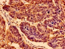 Invitrogen TrkA Polyclonal Antibody 100 &mu;g | Buy Online | Invitrogen&trade; | Fisher Scientific