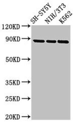 Invitrogen TrkA Polyclonal Antibody 100 &mu;g | Buy Online | Invitrogen&trade; | Fisher Scientific